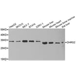 Western blot - DHRS2 antibody from Signalway Antibody (38924) - Antibodies.com