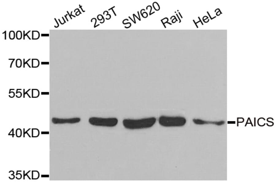 Western blot - PAICS antibody from Signalway Antibody (38928) - Antibodies.com