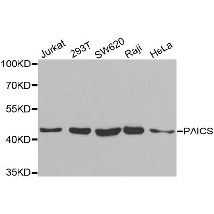 Western blot - PAICS antibody from Signalway Antibody (38928) - Antibodies.com