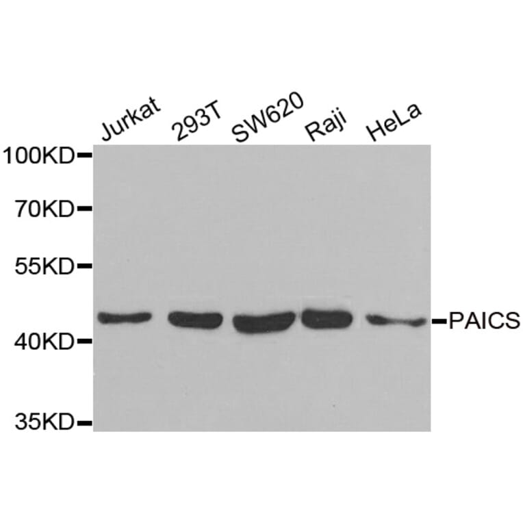 Western blot - PAICS antibody from Signalway Antibody (38928) - Antibodies.com