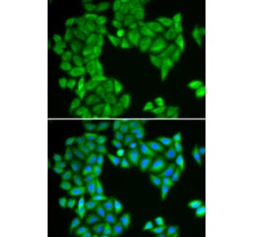 Immunofluorescence - SPAG5 antibody from Signalway Antibody (38929) - Antibodies.com