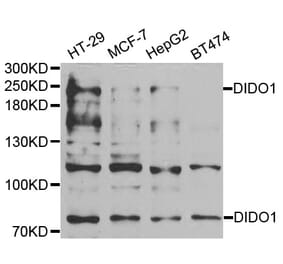 Western blot - DIDO1 antibody from Signalway Antibody (38930) - Antibodies.com