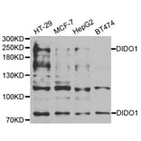 Western blot - DIDO1 antibody from Signalway Antibody (38930) - Antibodies.com