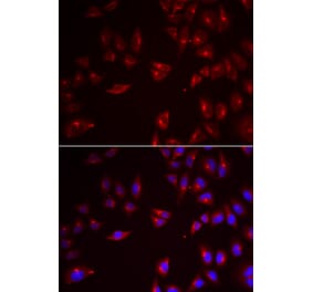 Immunofluorescence - PRAME antibody from Signalway Antibody (38933) - Antibodies.com