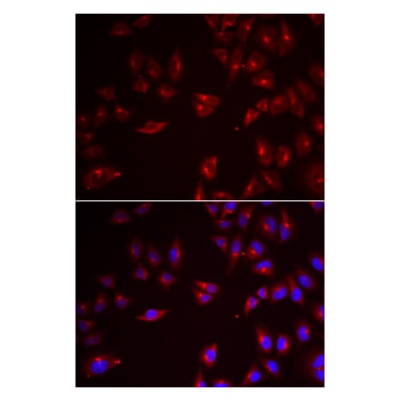 Immunofluorescence - PRAME antibody from Signalway Antibody (38933) - Antibodies.com