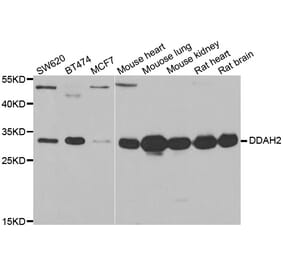 Western blot - DDAH2 antibody from Signalway Antibody (38934) - Antibodies.com