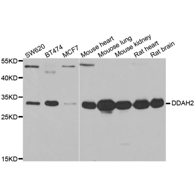 Western blot - DDAH2 antibody from Signalway Antibody (38934) - Antibodies.com