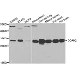 Western blot - DDAH2 antibody from Signalway Antibody (38934) - Antibodies.com