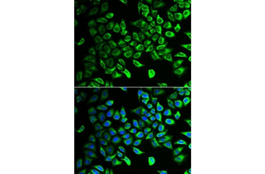 Immunofluorescence - DDAH2 antibody from Signalway Antibody (38934) - Antibodies.com