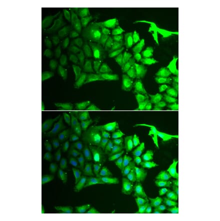 Immunofluorescence - AIPL1 antibody from Signalway Antibody (38935) - Antibodies.com