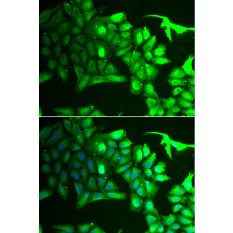 Immunofluorescence - AIPL1 antibody from Signalway Antibody (38935) - Antibodies.com