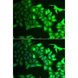 Immunofluorescence - AIPL1 antibody from Signalway Antibody (38935) - Antibodies.com