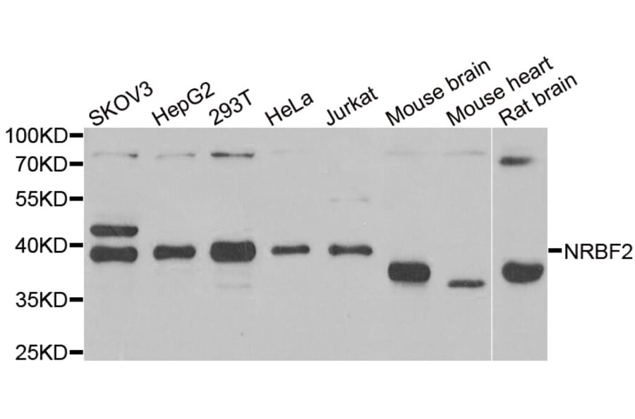 Western blot - NRBF2 antibody from Signalway Antibody (38939) - Antibodies.com