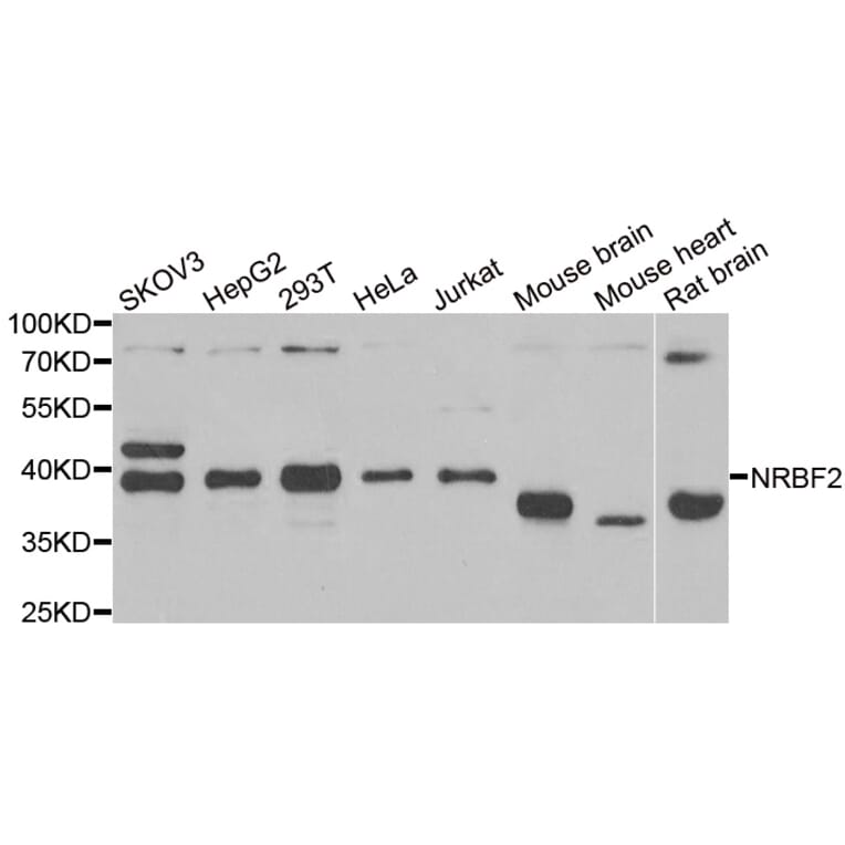 Western blot - NRBF2 antibody from Signalway Antibody (38939) - Antibodies.com