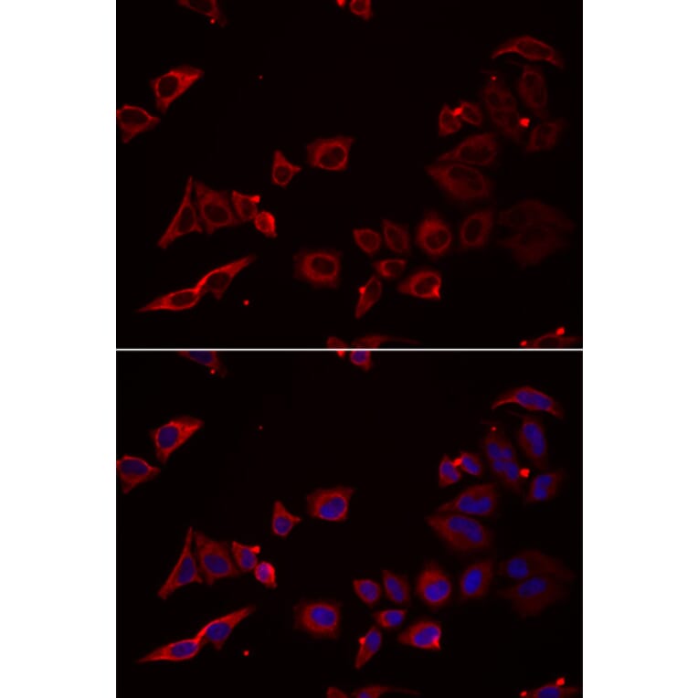 Immunofluorescence - NRBF2 antibody from Signalway Antibody (38939) - Antibodies.com