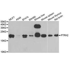Western blot - PTRH2 antibody from Signalway Antibody (38942) - Antibodies.com