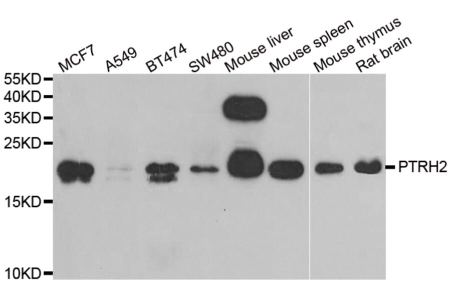 Western blot - PTRH2 antibody from Signalway Antibody (38942) - Antibodies.com