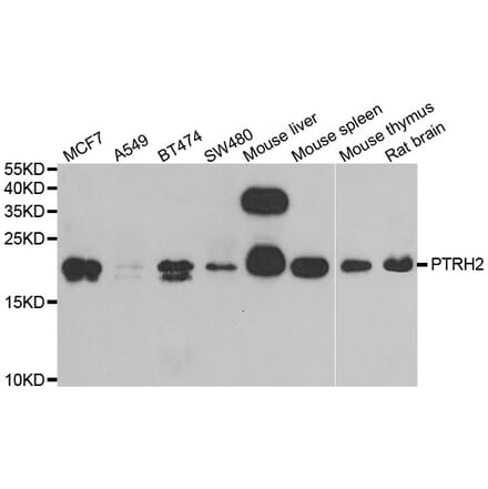 Western blot - PTRH2 antibody from Signalway Antibody (38942) - Antibodies.com