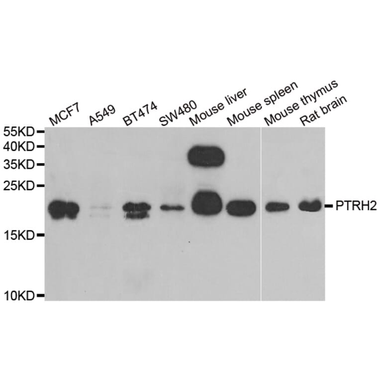 Western blot - PTRH2 antibody from Signalway Antibody (38942) - Antibodies.com