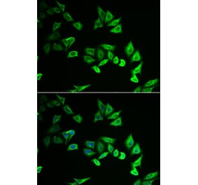 Immunofluorescence - MYOZ2 antibody from Signalway Antibody (38944) - Antibodies.com