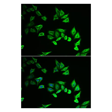 Immunofluorescence - MYOZ2 antibody from Signalway Antibody (38944) - Antibodies.com