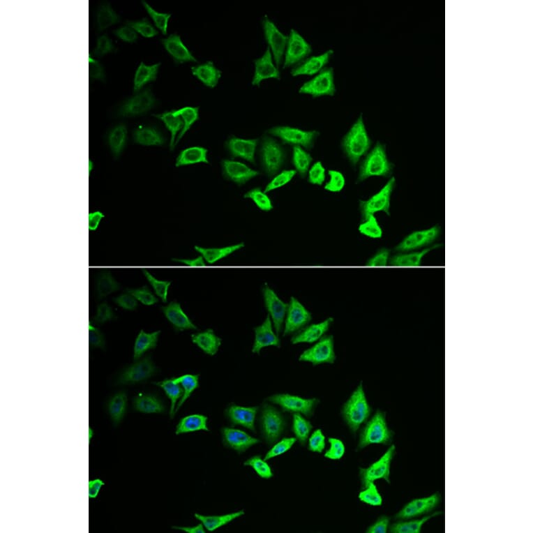 Immunofluorescence - MYOZ2 antibody from Signalway Antibody (38944) - Antibodies.com