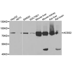 Western blot - ACSS2 antibody from Signalway Antibody (38947) - Antibodies.com
