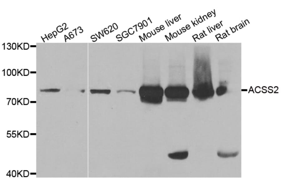 Western blot - ACSS2 antibody from Signalway Antibody (38947) - Antibodies.com