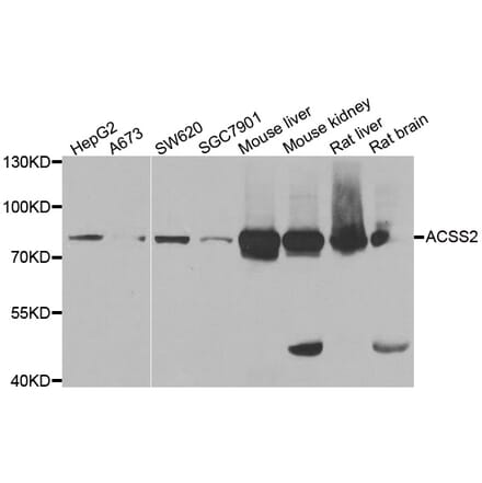 Western blot - ACSS2 antibody from Signalway Antibody (38947) - Antibodies.com