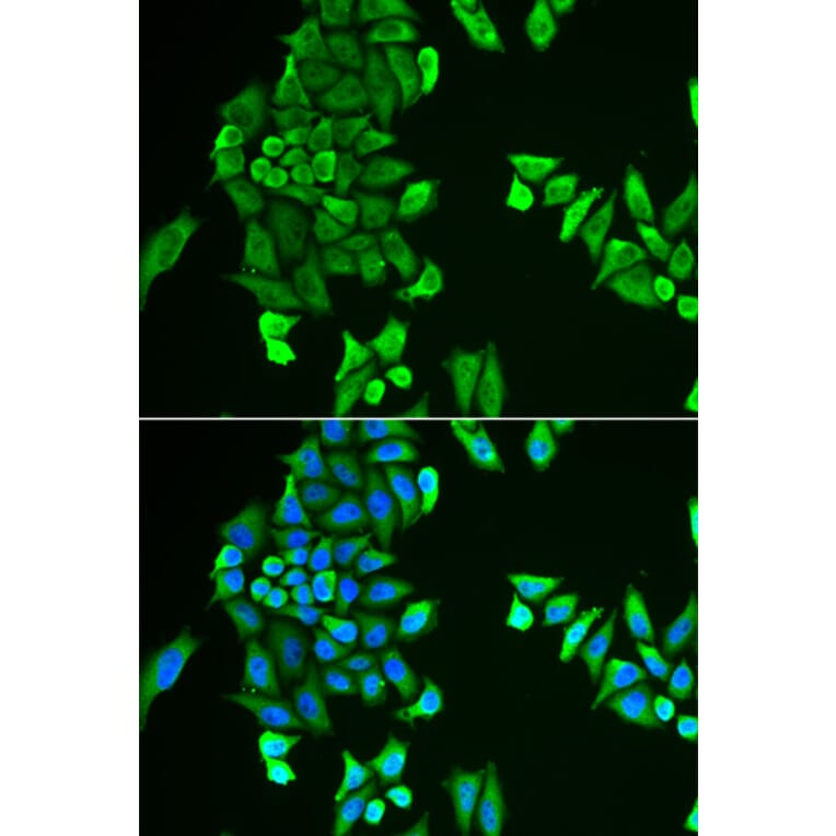 Immunofluorescence - ACSS2 antibody from Signalway Antibody (38947) - Antibodies.com