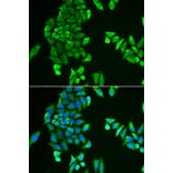 Immunofluorescence - ACSS2 antibody from Signalway Antibody (38947) - Antibodies.com