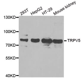 Western blot - TRPV5 antibody from Signalway Antibody (38948) - Antibodies.com