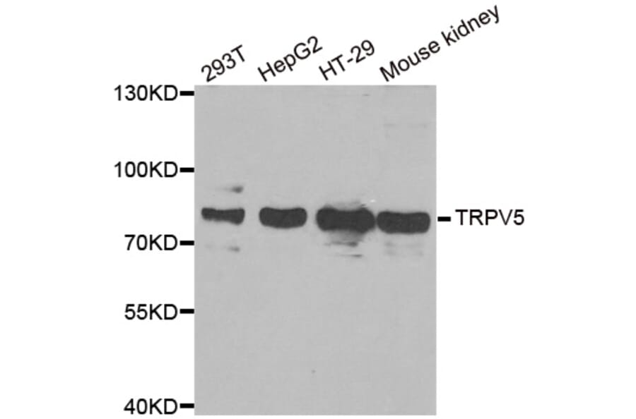 Western blot - TRPV5 antibody from Signalway Antibody (38948) - Antibodies.com
