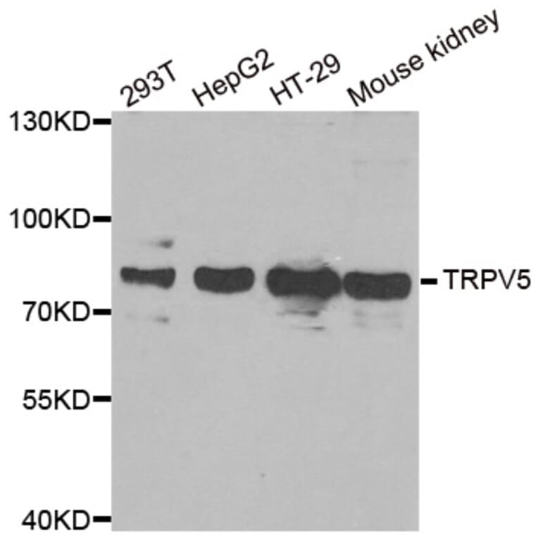 Western blot - TRPV5 antibody from Signalway Antibody (38948) - Antibodies.com