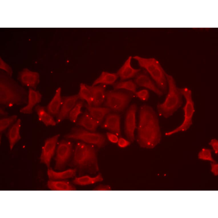 Immunofluorescence - TRPV5 antibody from Signalway Antibody (38948) - Antibodies.com