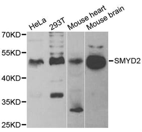 Western blot - SMYD2 antibody from Signalway Antibody (38949) - Antibodies.com