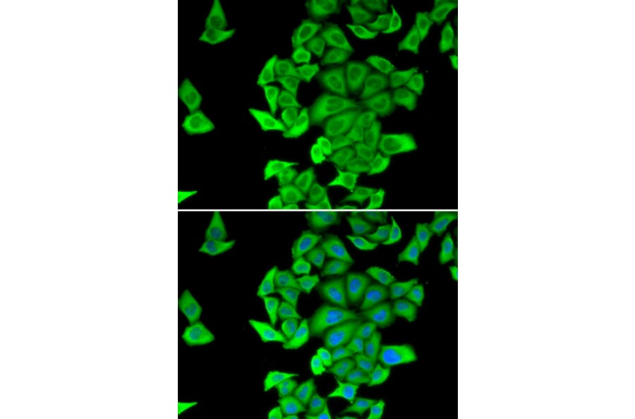 Immunofluorescence - SMYD2 antibody from Signalway Antibody (38949) - Antibodies.com