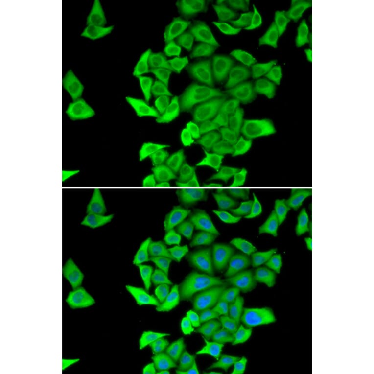 Immunofluorescence - SMYD2 antibody from Signalway Antibody (38949) - Antibodies.com