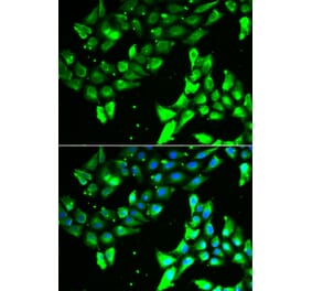 Immunofluorescence - KIF2B antibody from Signalway Antibody (38953) - Antibodies.com