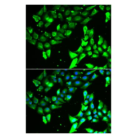 Immunofluorescence - KIF2B antibody from Signalway Antibody (38953) - Antibodies.com