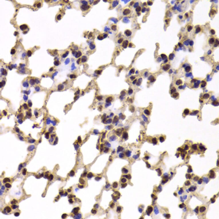 Immunohistochemistry - KIF2B antibody from Signalway Antibody (38953) - Antibodies.com