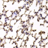 Immunohistochemistry - KIF2B antibody from Signalway Antibody (38953) - Antibodies.com