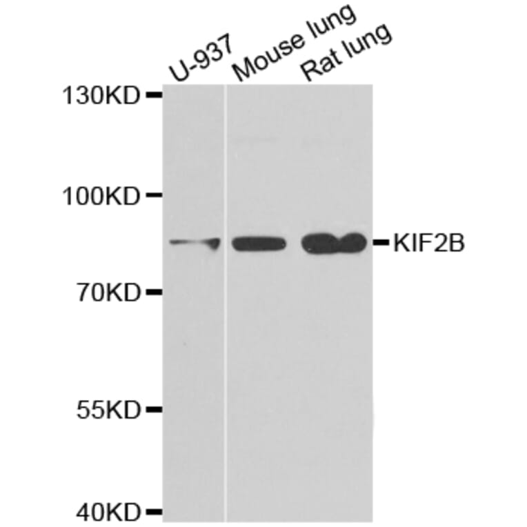 Western blot - KIF2B antibody from Signalway Antibody (38953) - Antibodies.com