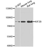 Western blot - KIF2B antibody from Signalway Antibody (38953) - Antibodies.com