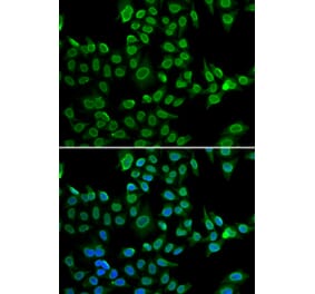 Immunofluorescence - LMNB2 antibody from Signalway Antibody (38955) - Antibodies.com