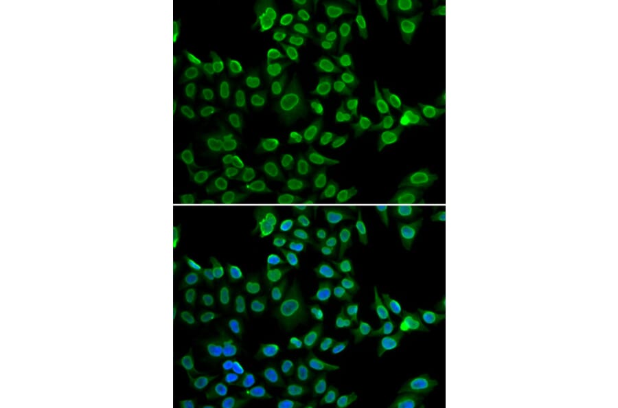 Immunofluorescence - LMNB2 antibody from Signalway Antibody (38955) - Antibodies.com