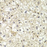 Immunohistochemistry - LMNB2 antibody from Signalway Antibody (38955) - Antibodies.com