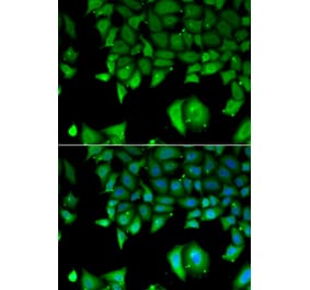 Immunofluorescence - IL17F antibody from Signalway Antibody (38959) - Antibodies.com