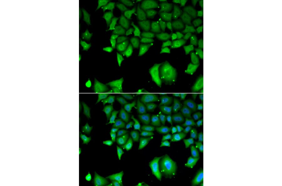 Immunofluorescence - IL17F antibody from Signalway Antibody (38959) - Antibodies.com