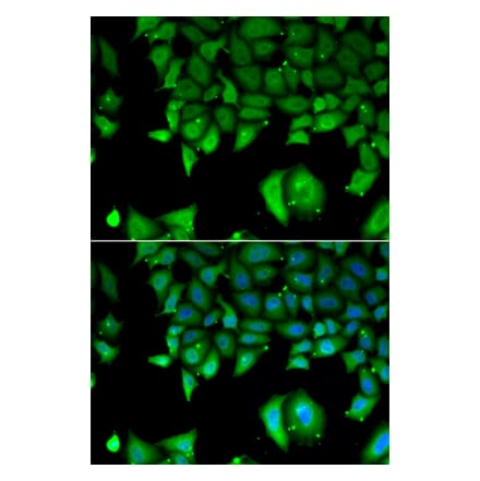 Immunofluorescence - IL17F antibody from Signalway Antibody (38959) - Antibodies.com
